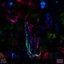 Miscellaneous cover