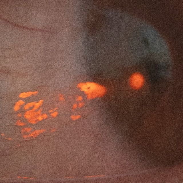 Hurt A Fly